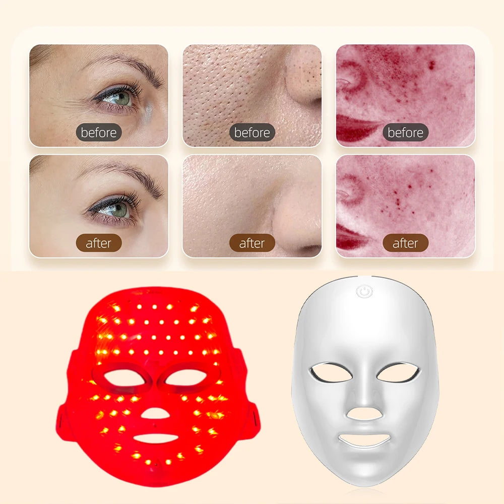 7-Color LED Light Therapy Mask