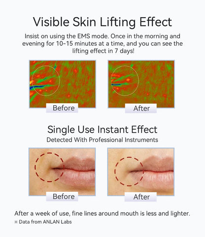 Microcurrent Facial Massager Pro